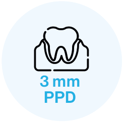 3 mm PPD