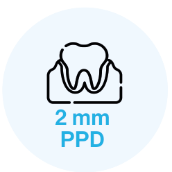 2 mm PPD