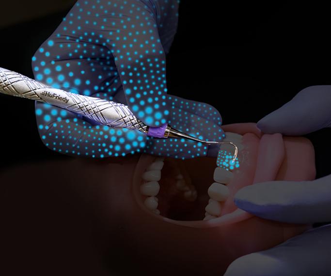 Visualisation des capteurs TrueFit pendant une simulation de détartrage avec Harmony